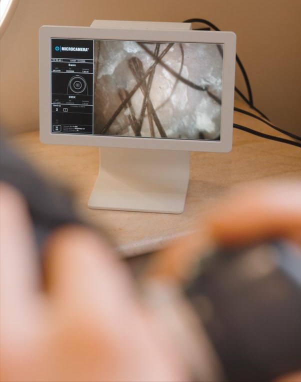 Analisi della cute con microcamera tricologica